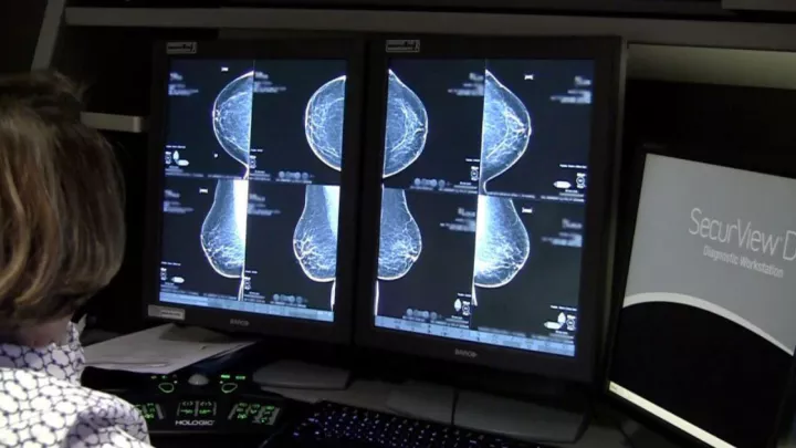3D mammogram images